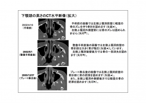 CT画像比較9-10