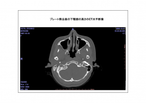 CT画像比較7-8